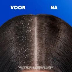 6x Head & Shoulders 2in1 Apple Fresh 300 ml